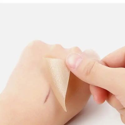 Silicone littekenplaten, banden, strippen - Genezende keloïde, keizersnede, buikopname - Chirurgische littekenbehandeling